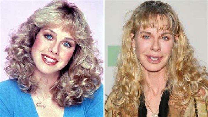 Jenilee Harrison And Reggie Jackson's Impact On Sports Medicine