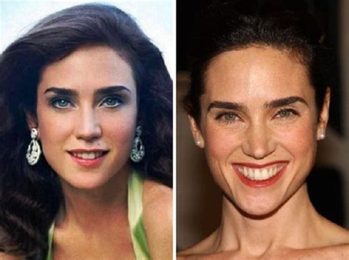 Jennifer Connelly Breast Reduction Plastic Surgery Before and After