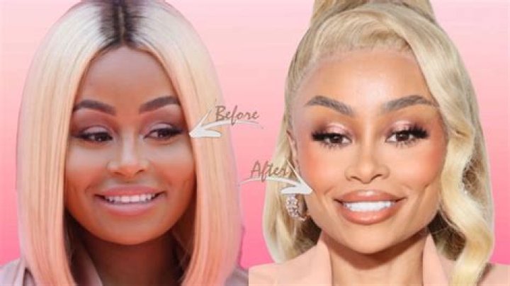 Unveil The Evolution Of Blac Chyna: Before And After