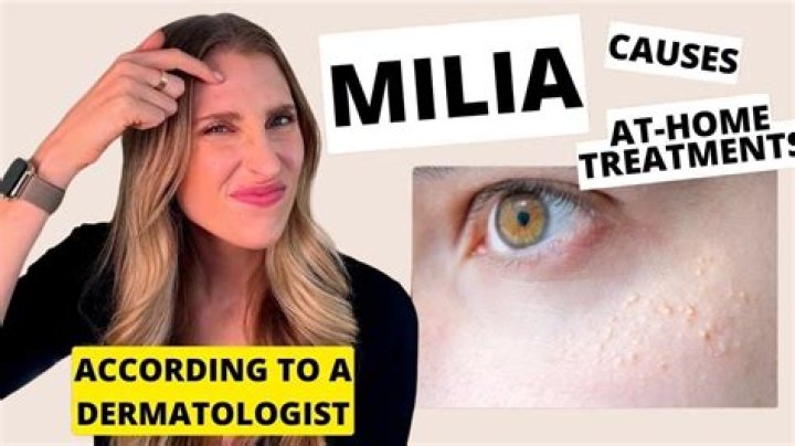 Who Is Millia Holme?